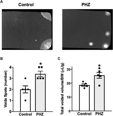 Impact of intravascular hemolysis on functional and molecular alterations in the urinary bladder: implications for an overactive bladder in sickle cell disease